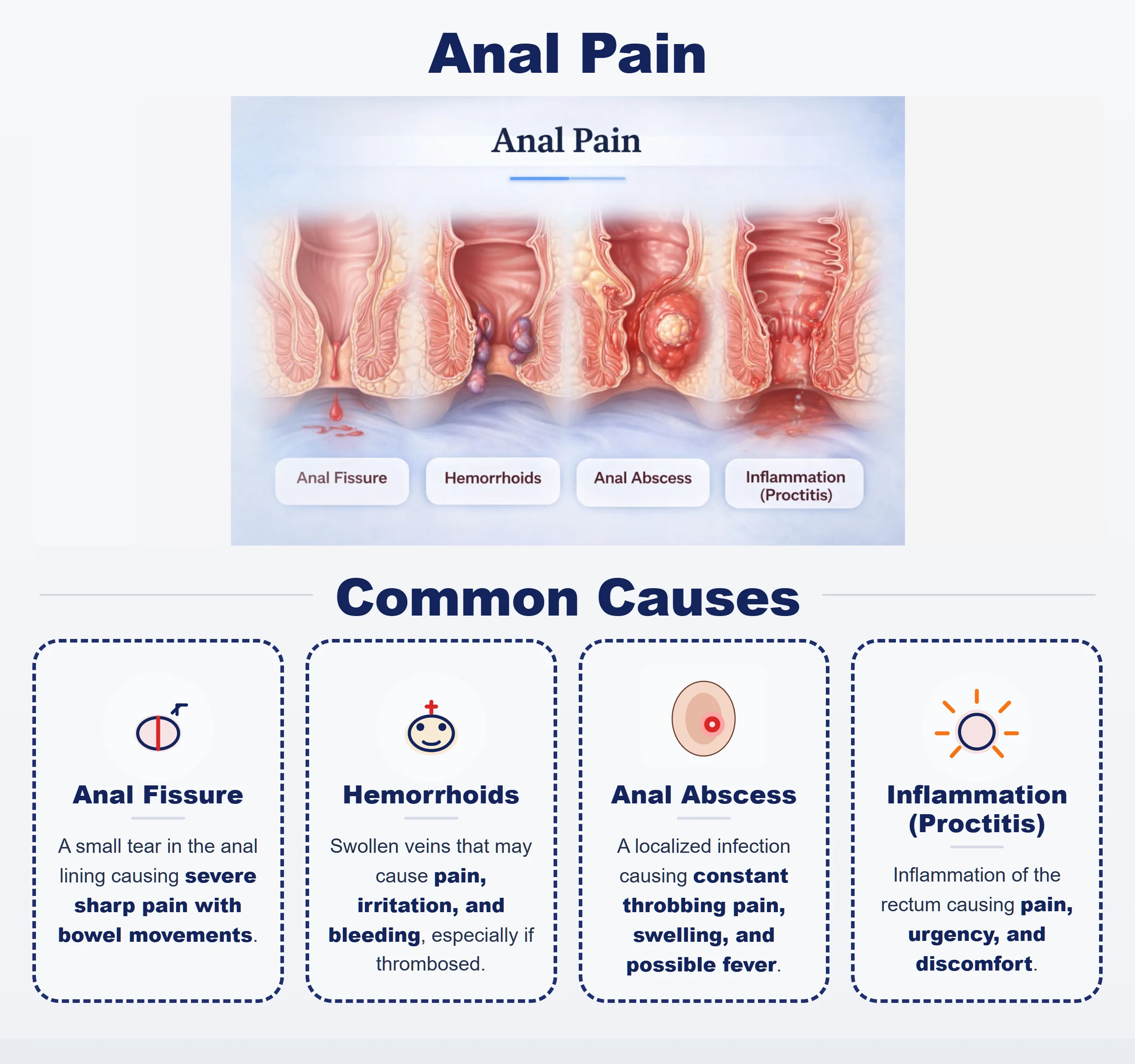 Medical illustration showing symptoms of anal pain including sharp pain swelling bleeding and irritation