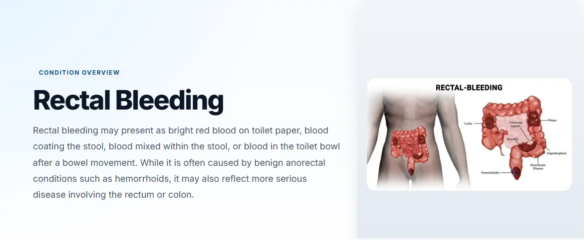 Rectal Bleeding | Causes, Symptoms & When to See a Doctor