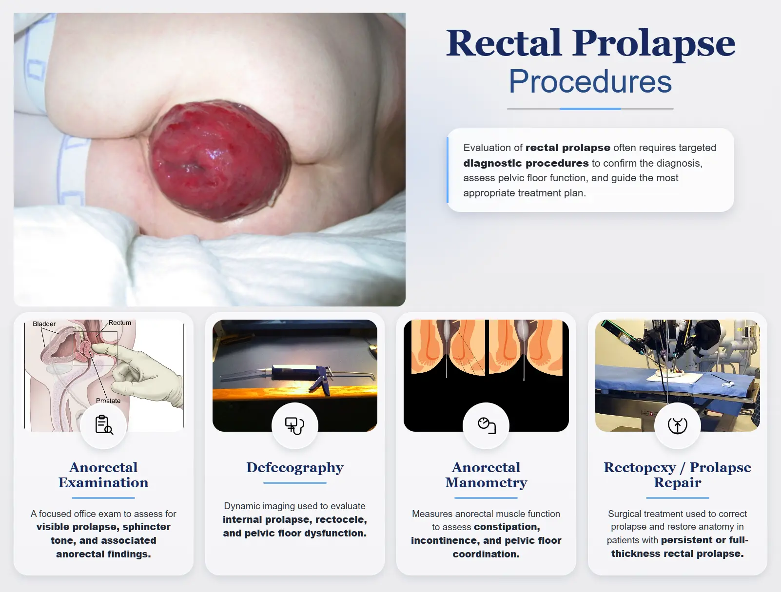 Medical illustration showing diagnostic testing and surgical treatment used for rectal prolapse