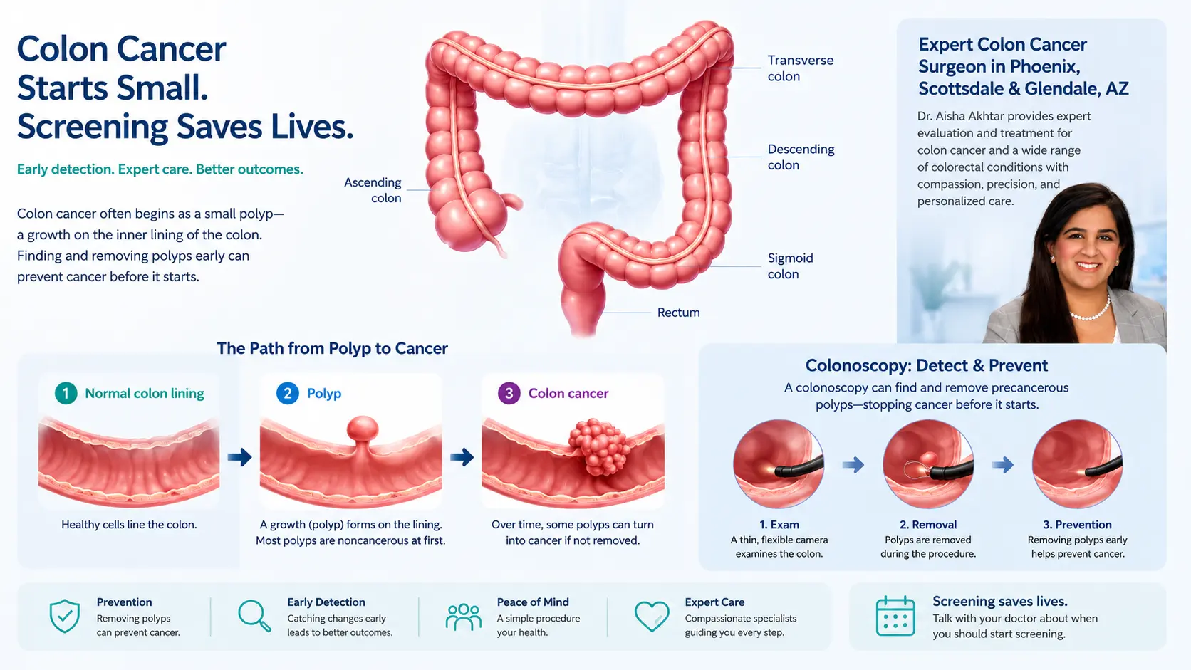 Colon cancer screening and prevention illustration showing colon polyps, colonoscopy, and expert care by Dr. Aisha Akhtar in Phoenix, AZ